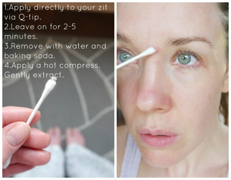 DIY Zit Zapper with Glycolic Acid Jenni Raincloud