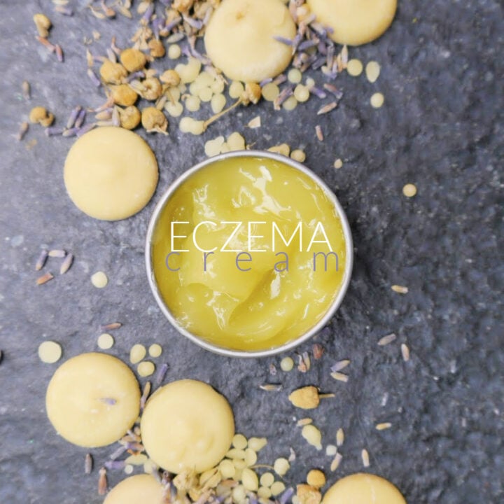 DIY Eczema Cream